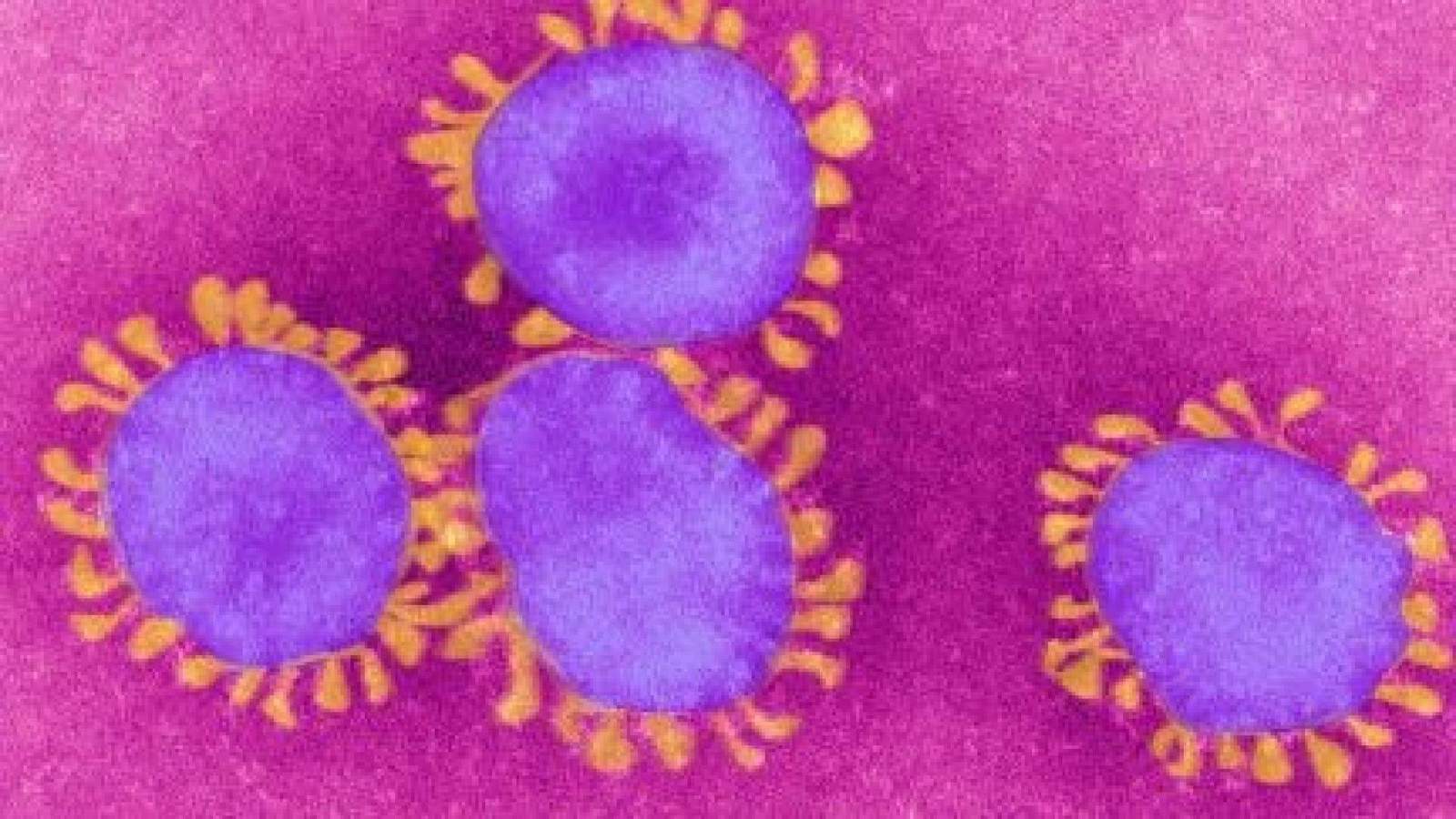 Possible case of coronavirus being treated at Duke University Hospital